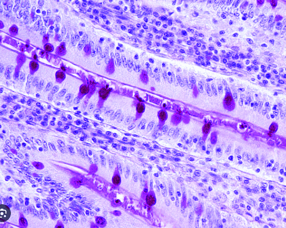 Corte histológico que muestra célula caliciforme secretora del mucus que permite dar estructura a la película lagrimal en la superficie ocular