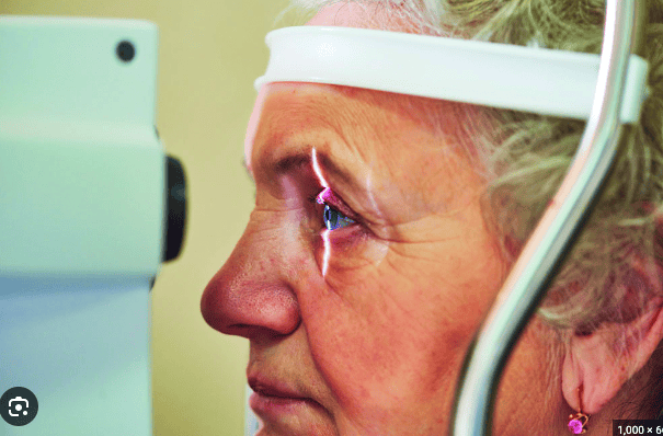 Mujer mayor, retratada de perfil, recibiendo un estudio médico de oftalmología para el estudio de hipertensión ocular y densidad vascular