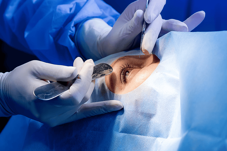 Imagen donde se realiza cirugía de glaucoma a persona adulta.